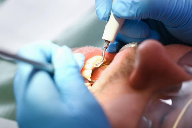 Best 24-Hour Emergency Dental Care in Litchfield, MI